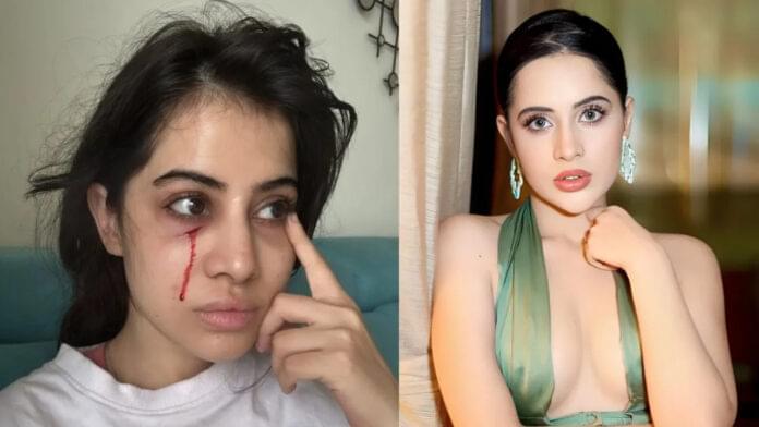 ਉਰਫੀ ਜਾਵੇਦ ਦੀਆਂ ਸੁੱਜੀਆਂ ਅੱਖਾਂ ਤੇ ਖੂਨ ਵਾਲਾ ਚਿਹਰਾ – ਪਾਲਤੂ ਬਿੱਲੀ ਨੇ ਮਾਰੀ ਖੁਰਚ, ਵੀਡੀਓ ਵਾਇਰਲ